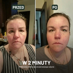 Veldonia | Szczotka do limfatycznego masażu twarzy